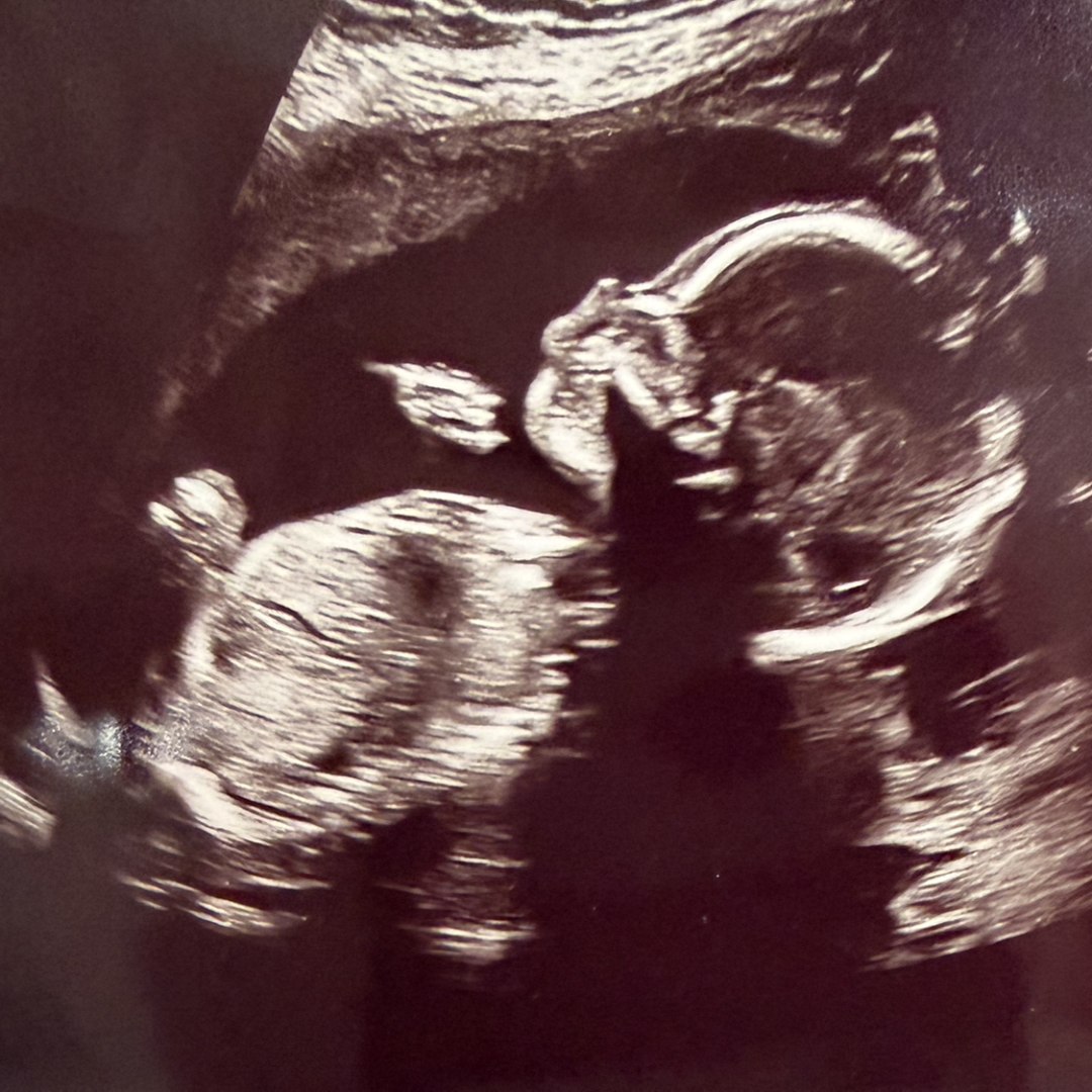 Photo shared by Elizabeth for their Babylist baby registry.