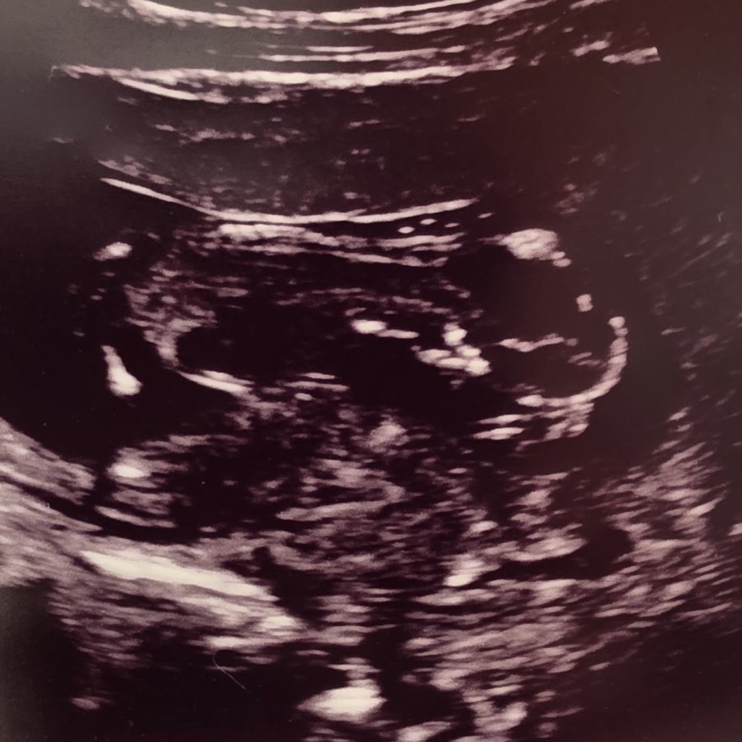 Photo shared by Elizabeth for their Babylist baby registry.