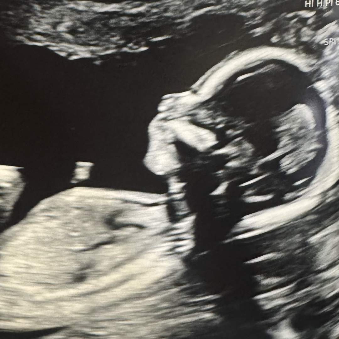 Photo shared by Becky for their Babylist baby registry.