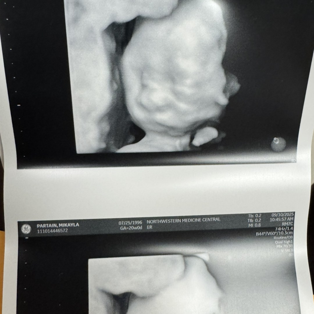 Photo shared by Mikayla for their Babylist baby registry.