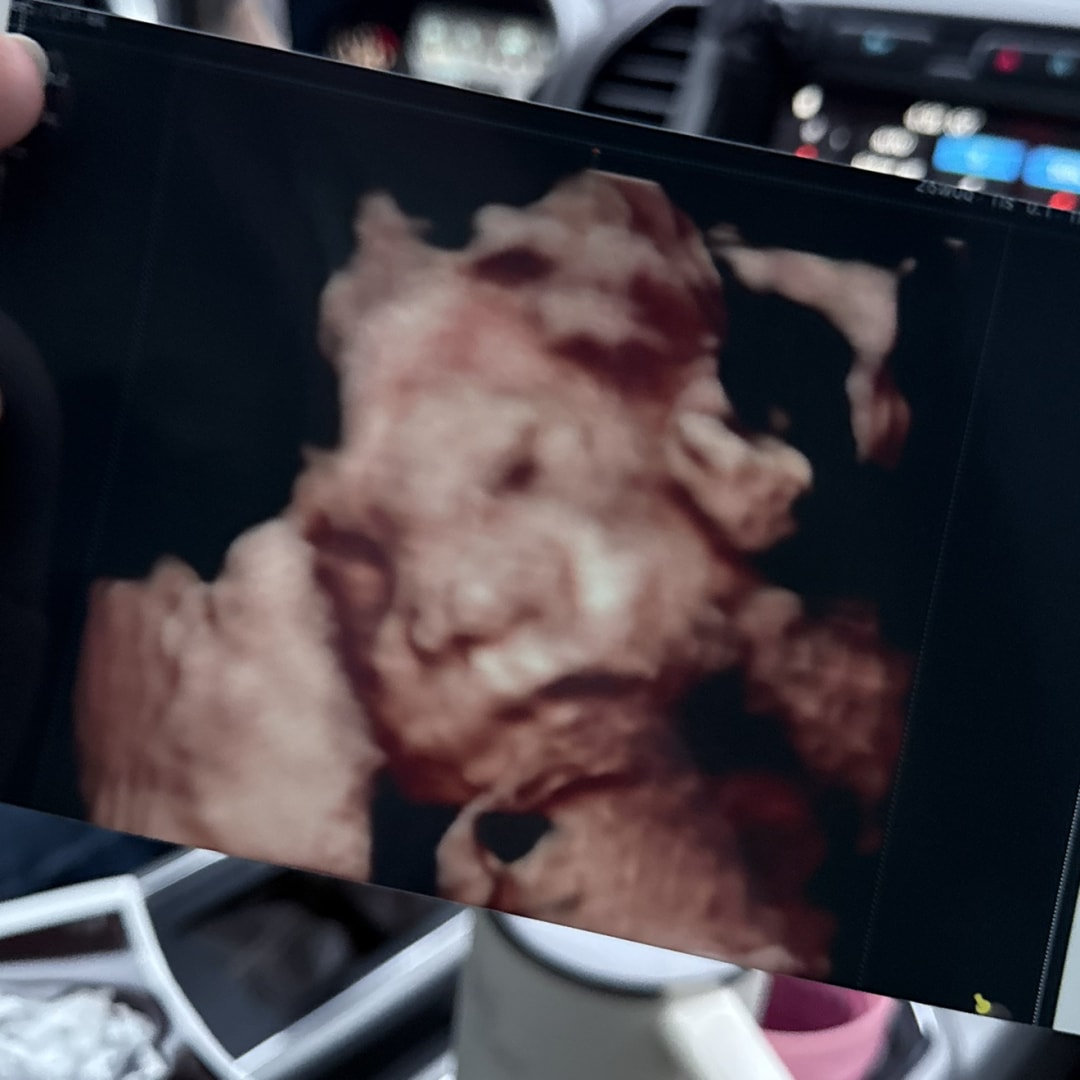 Photo shared by Victoria for their Babylist baby registry.