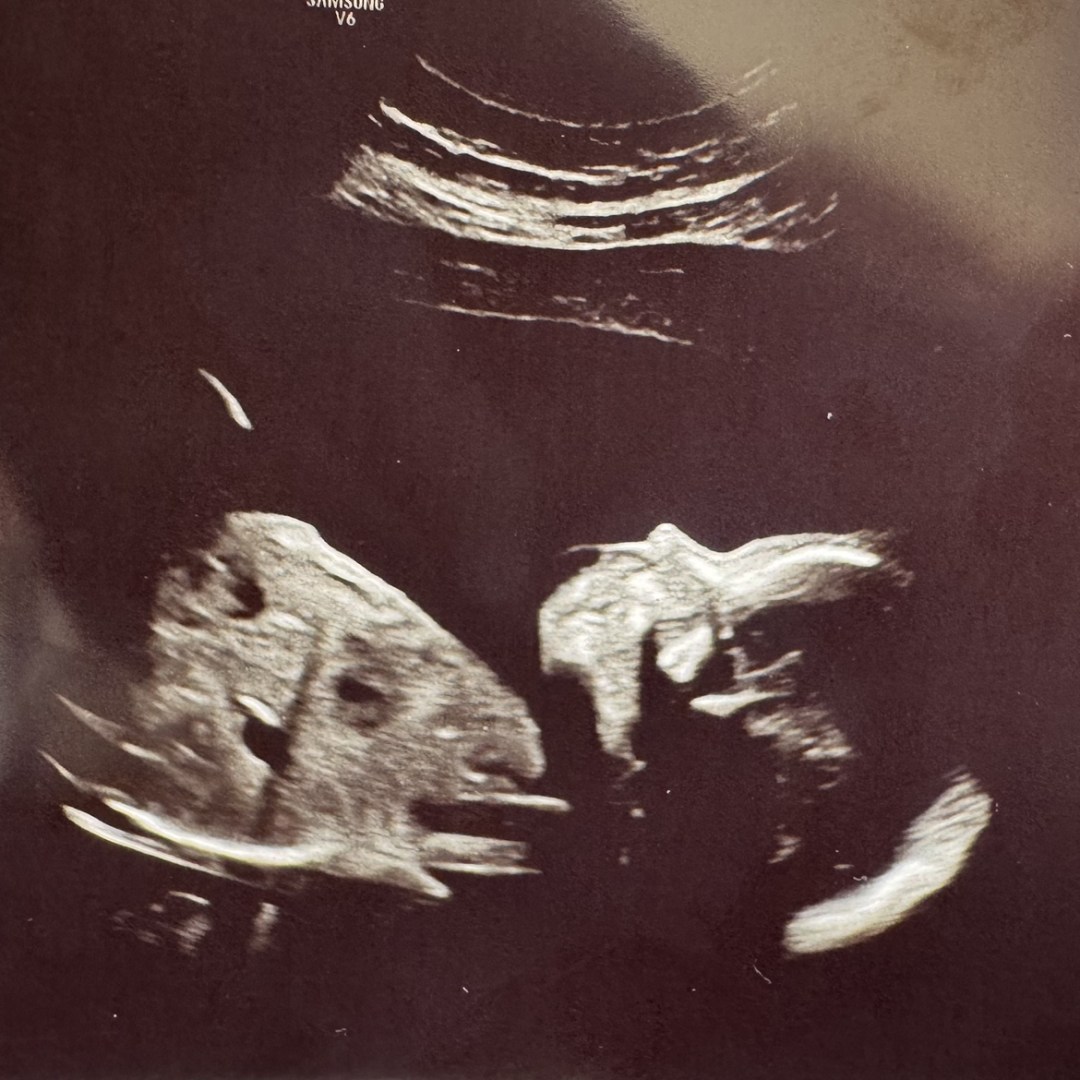 Photo shared by Tayler for their Babylist baby registry.