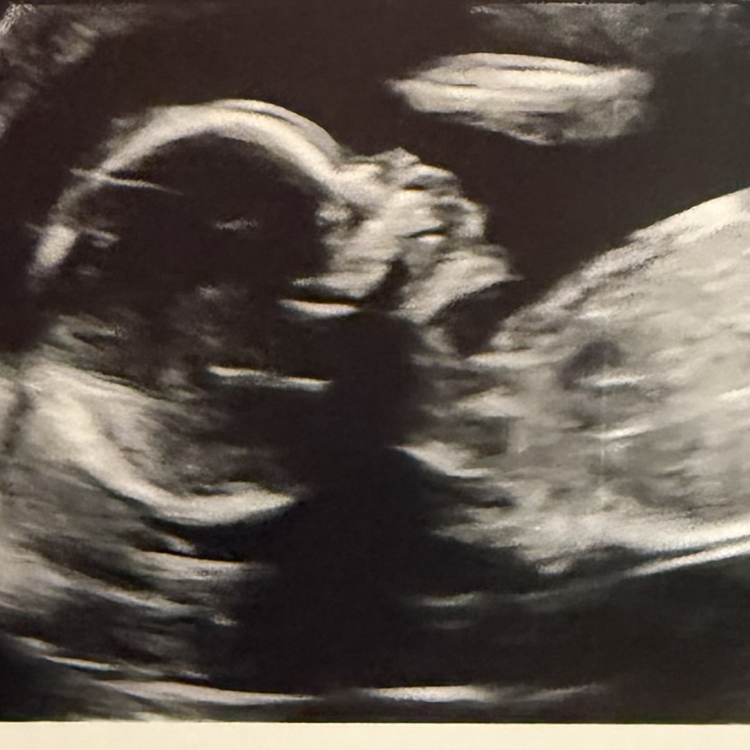 Photo shared by Paolina for their Babylist baby registry.