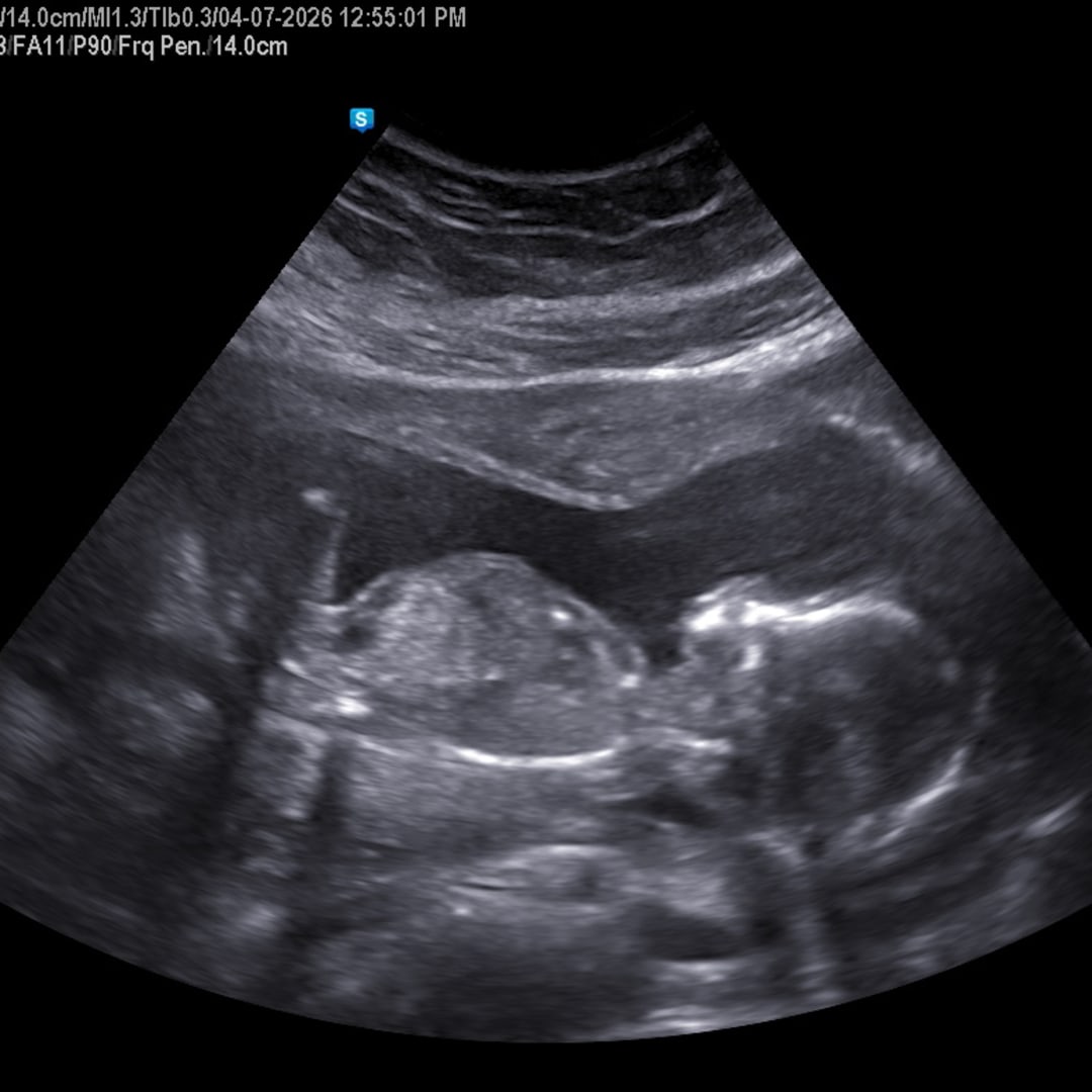 Photo shared by Hazel for their Babylist baby registry.