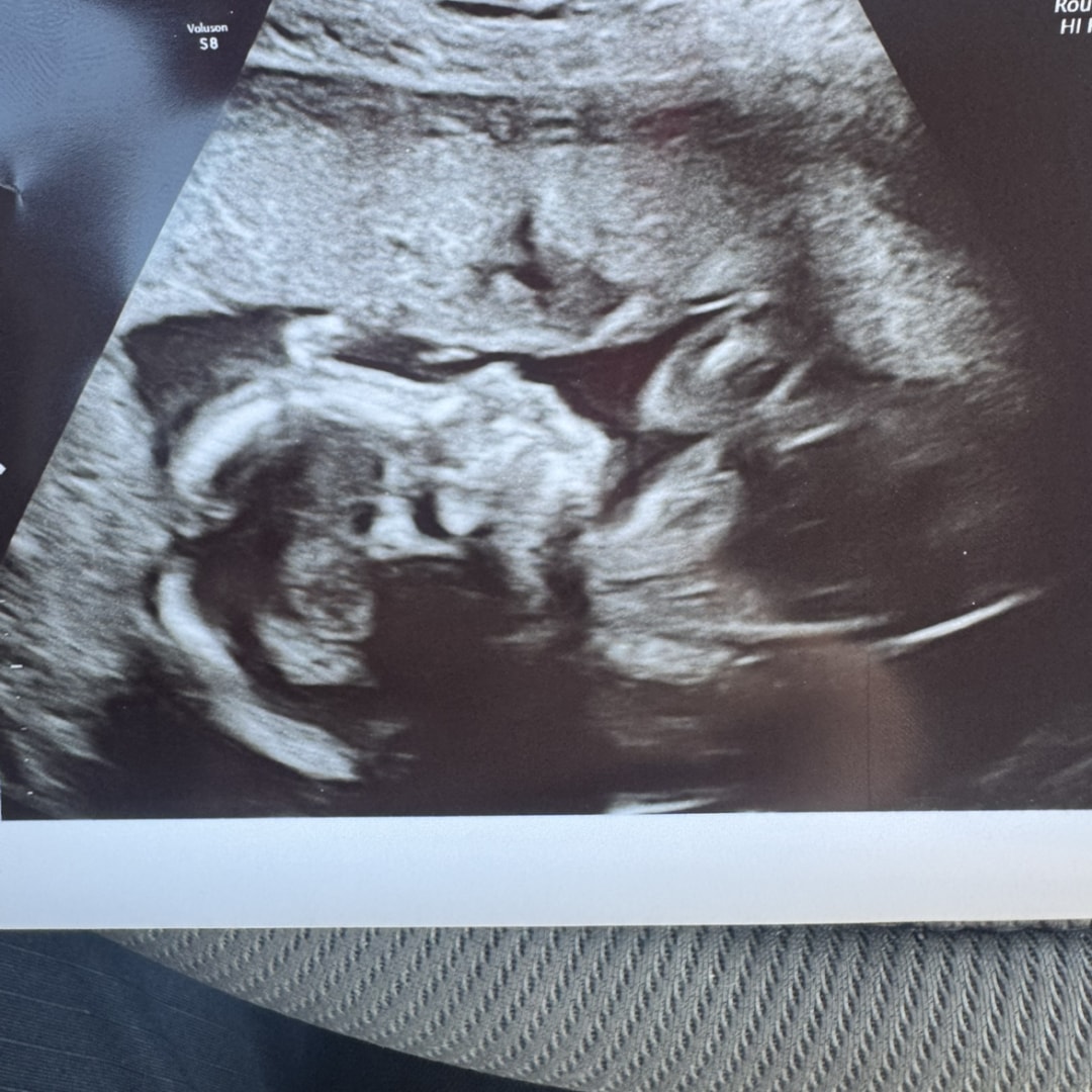 Photo shared by Kelsey for their Babylist baby registry.