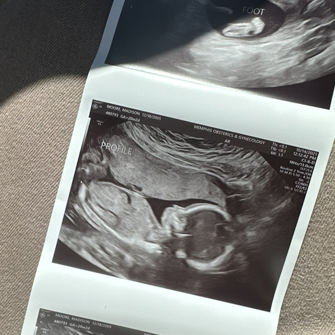 Photo shared by Madison for their Babylist baby registry.