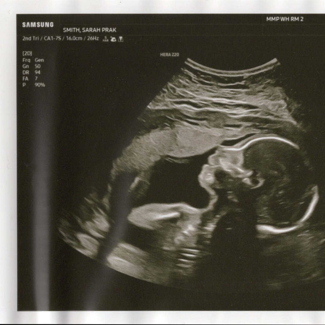 Photo shared by Sarah for their Babylist baby registry.