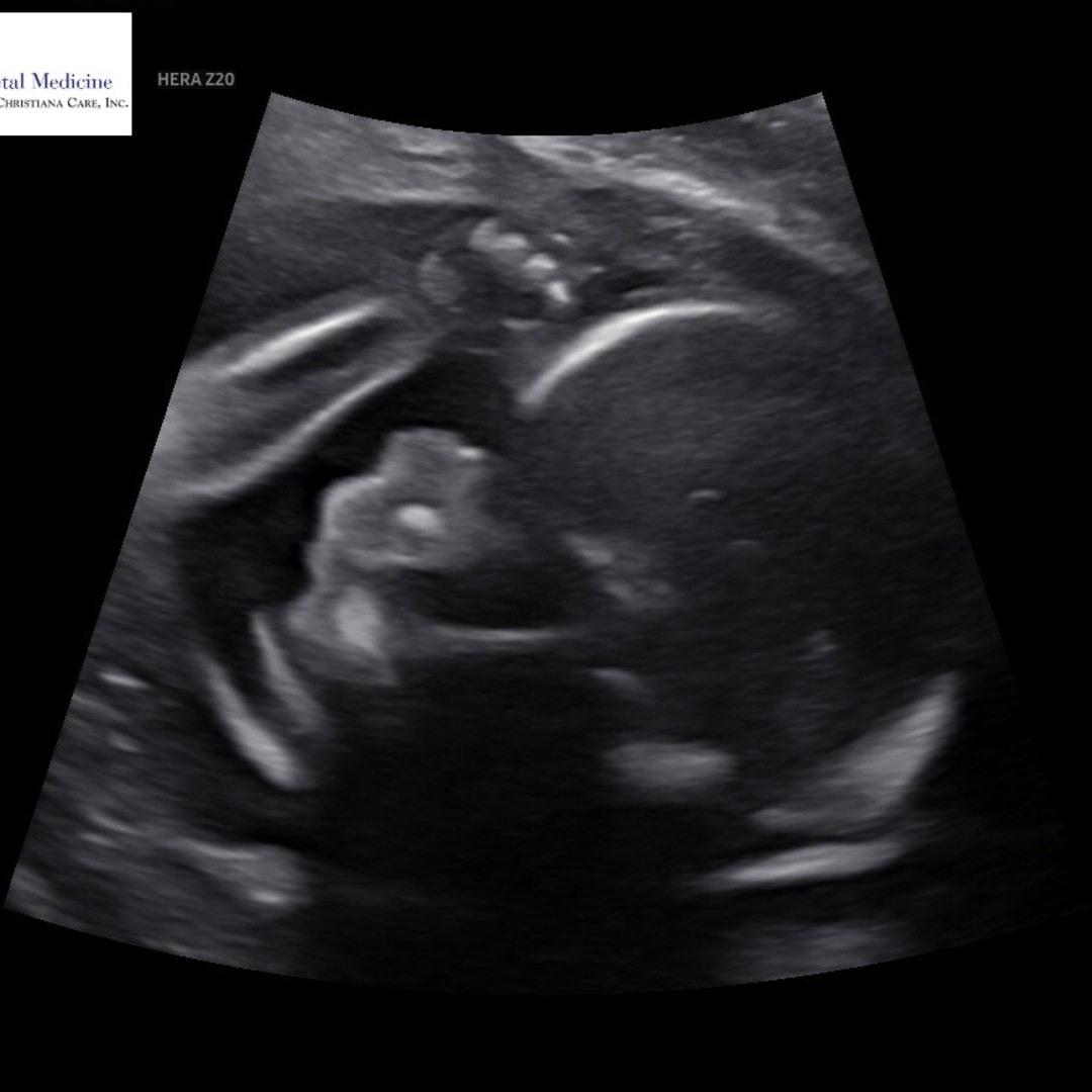 Photo shared by Tahj for their Babylist baby registry.