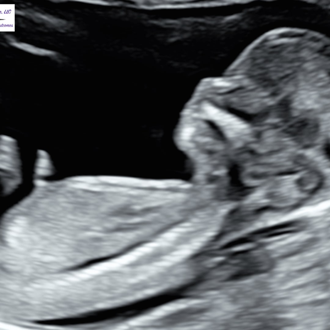 Photo shared by Hope for their Babylist baby registry.