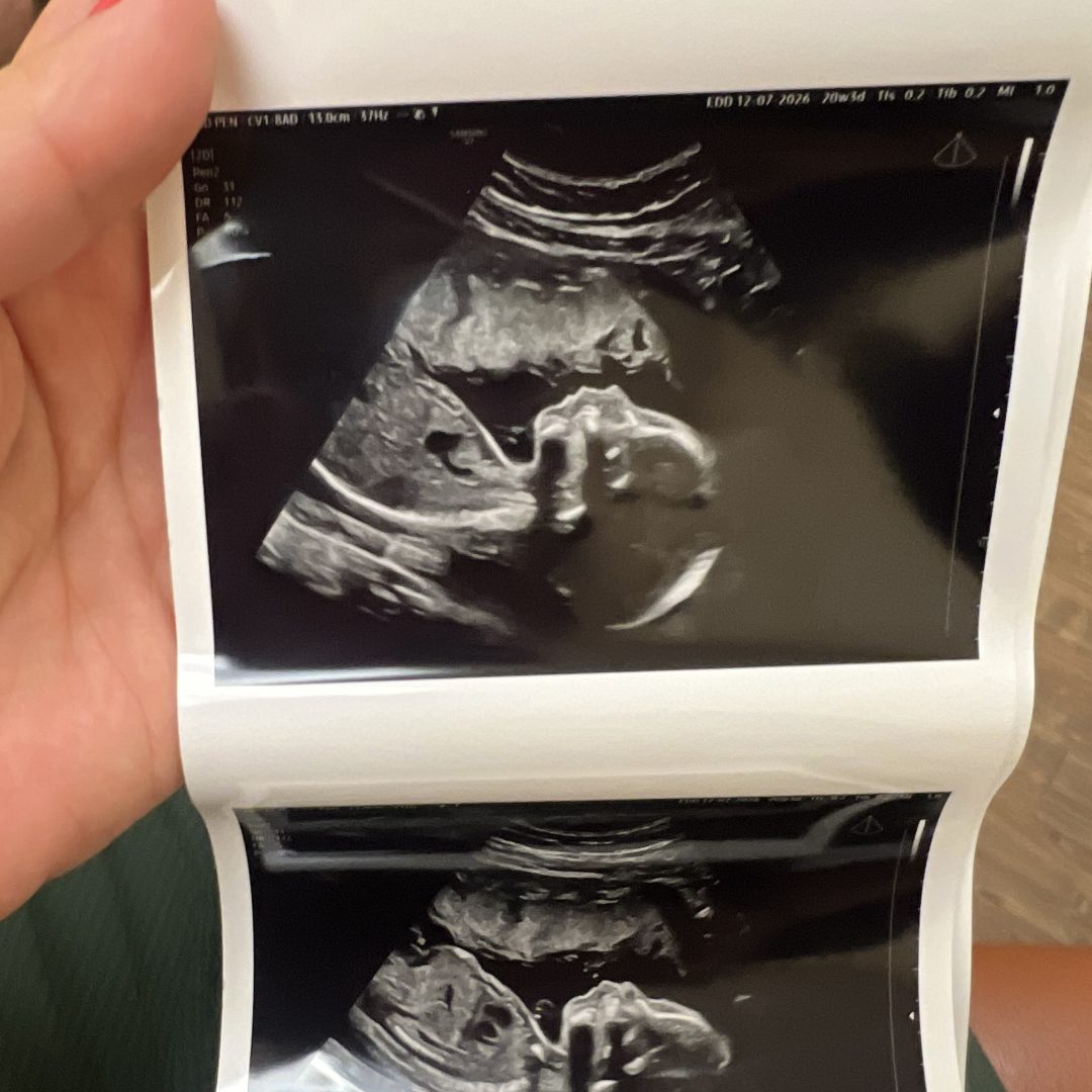Photo shared by Claire for their Babylist baby registry.