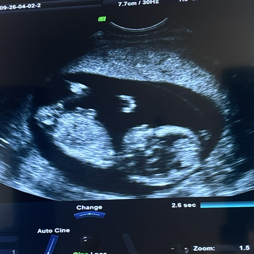 Photo shared by Frank for their Babylist baby registry.