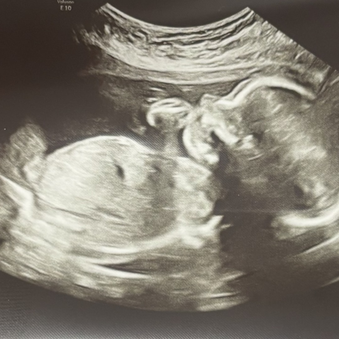 Photo shared by Jai’Lyn for their Babylist baby registry.
