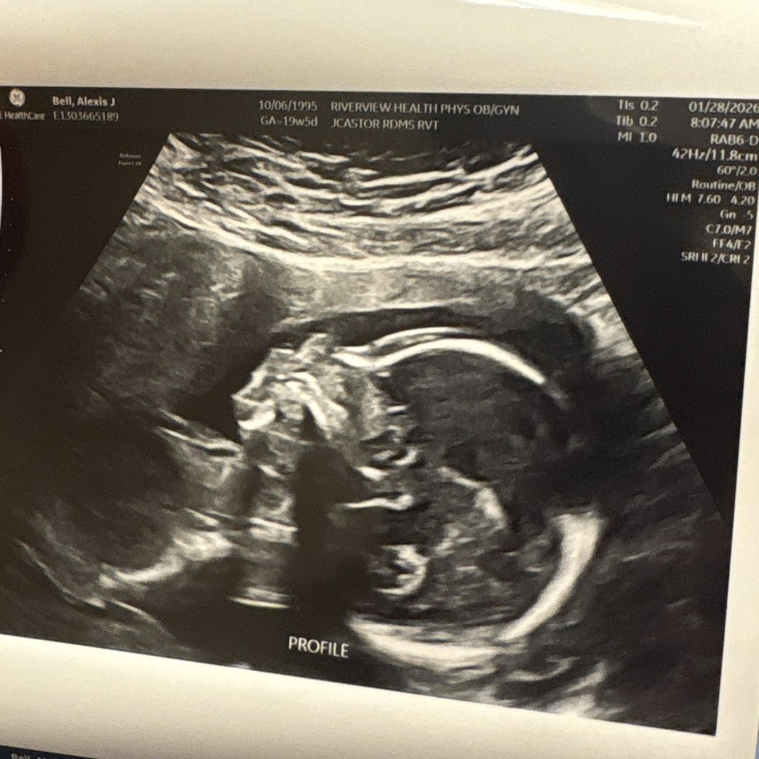 Photo shared by Lexi for their Babylist baby registry.