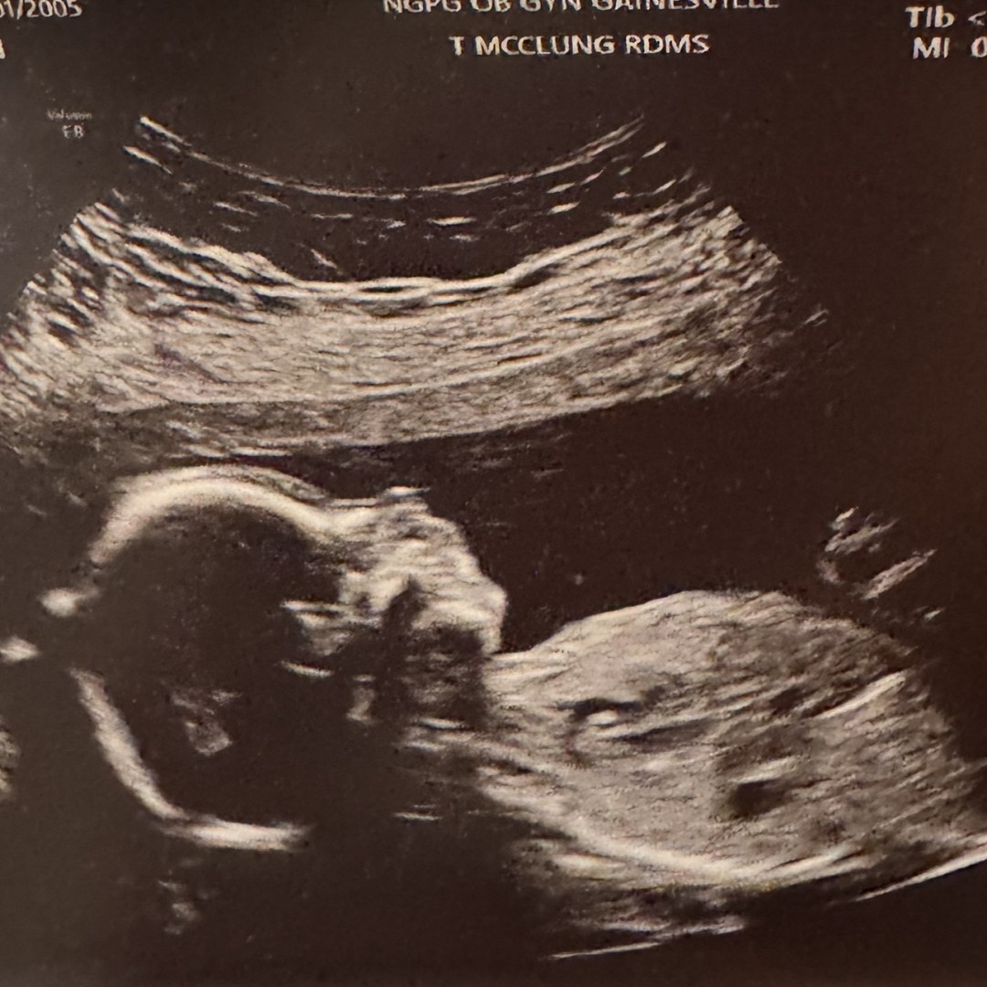 Photo shared by Daisy for their Babylist baby registry.