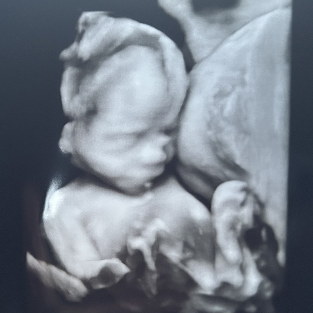 Photo shared by Gretchen for their Babylist baby registry.