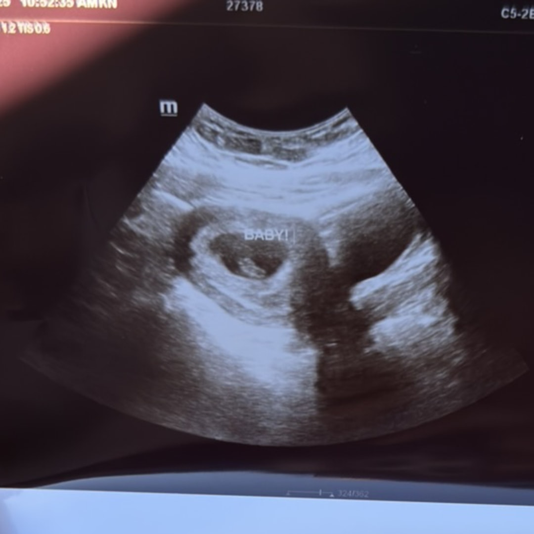 Photo shared by Stephanie for their Babylist baby registry.