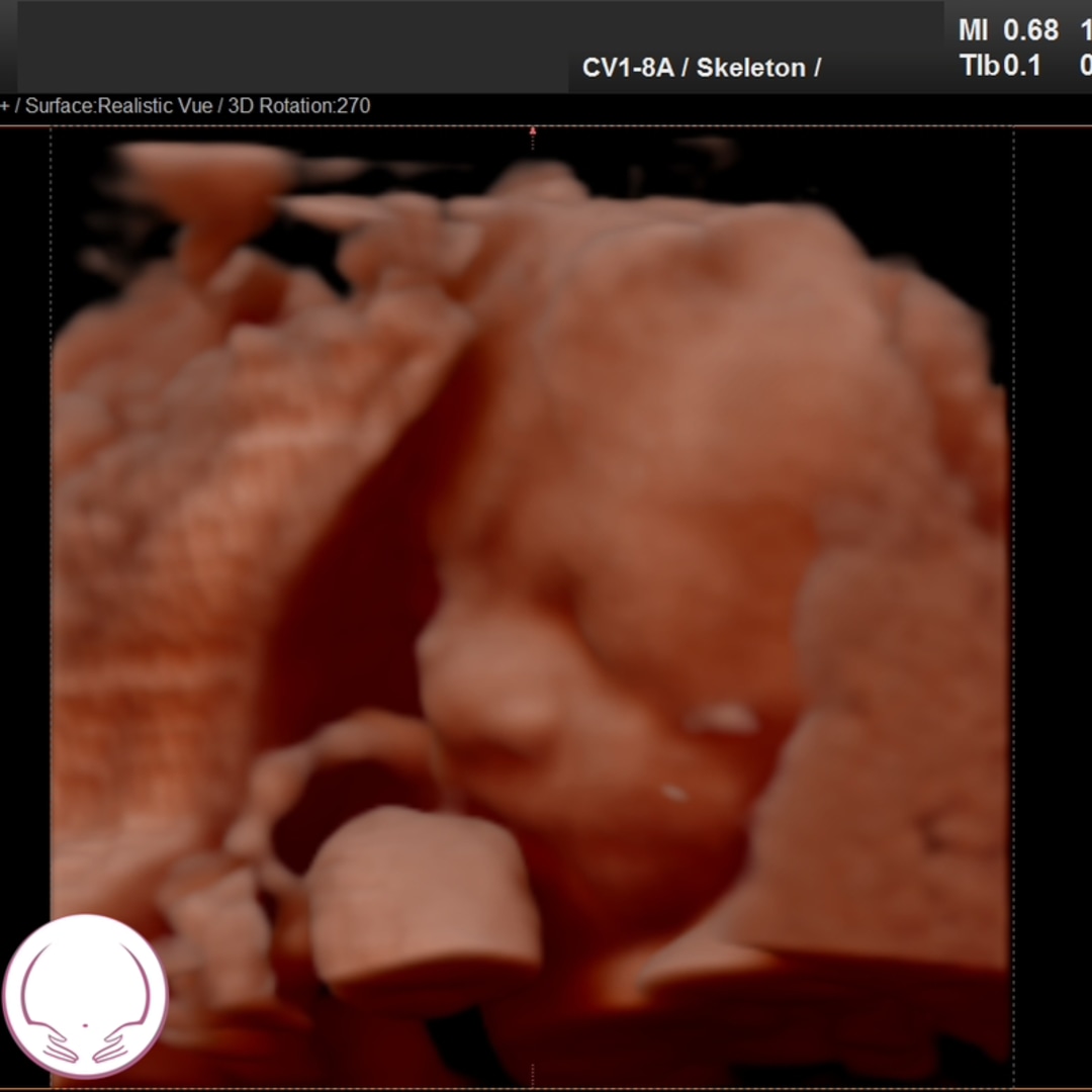 Photo shared by Ellie for their Babylist baby registry.