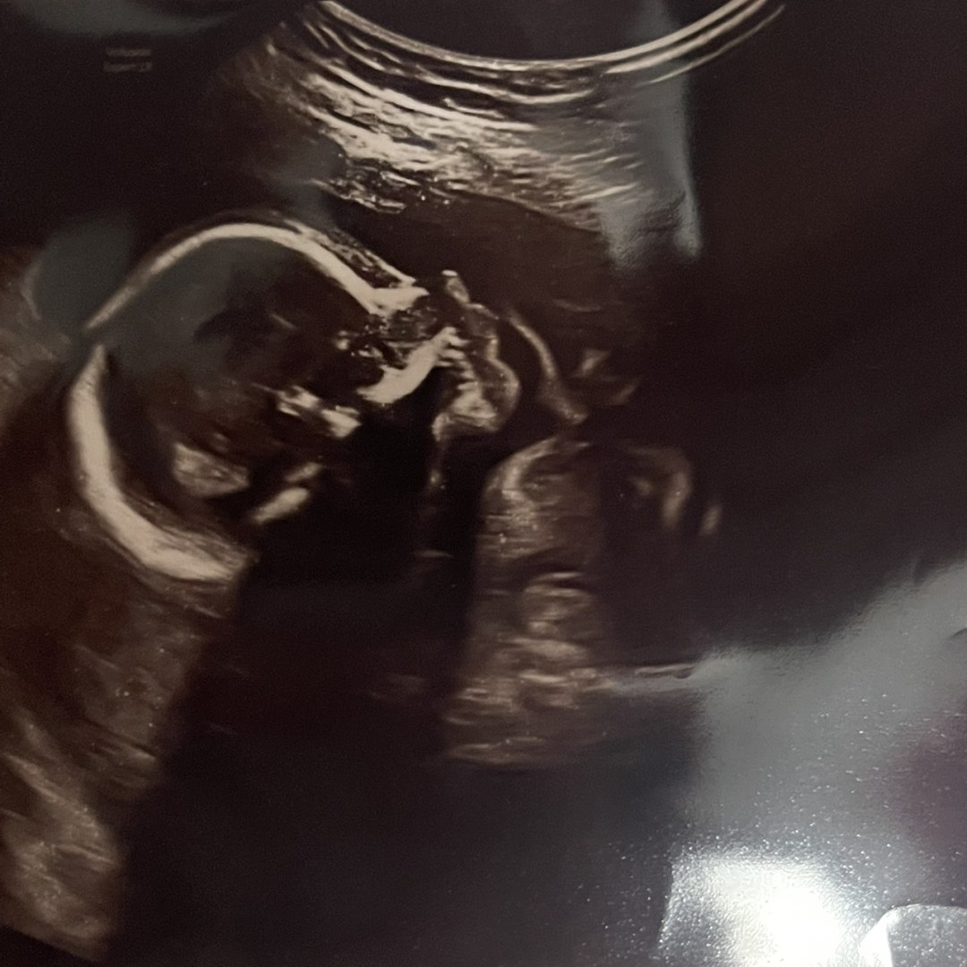 Photo shared by Alexus for their Babylist baby registry.