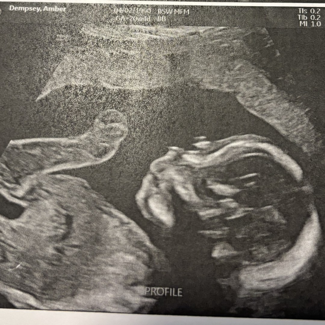 Photo shared by Amber for their Babylist baby registry.