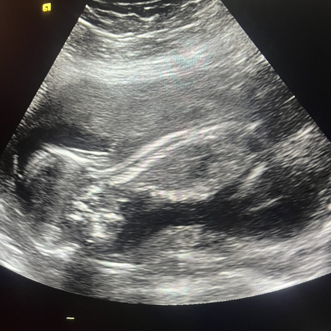 Photo shared by Emery for their Babylist baby registry.