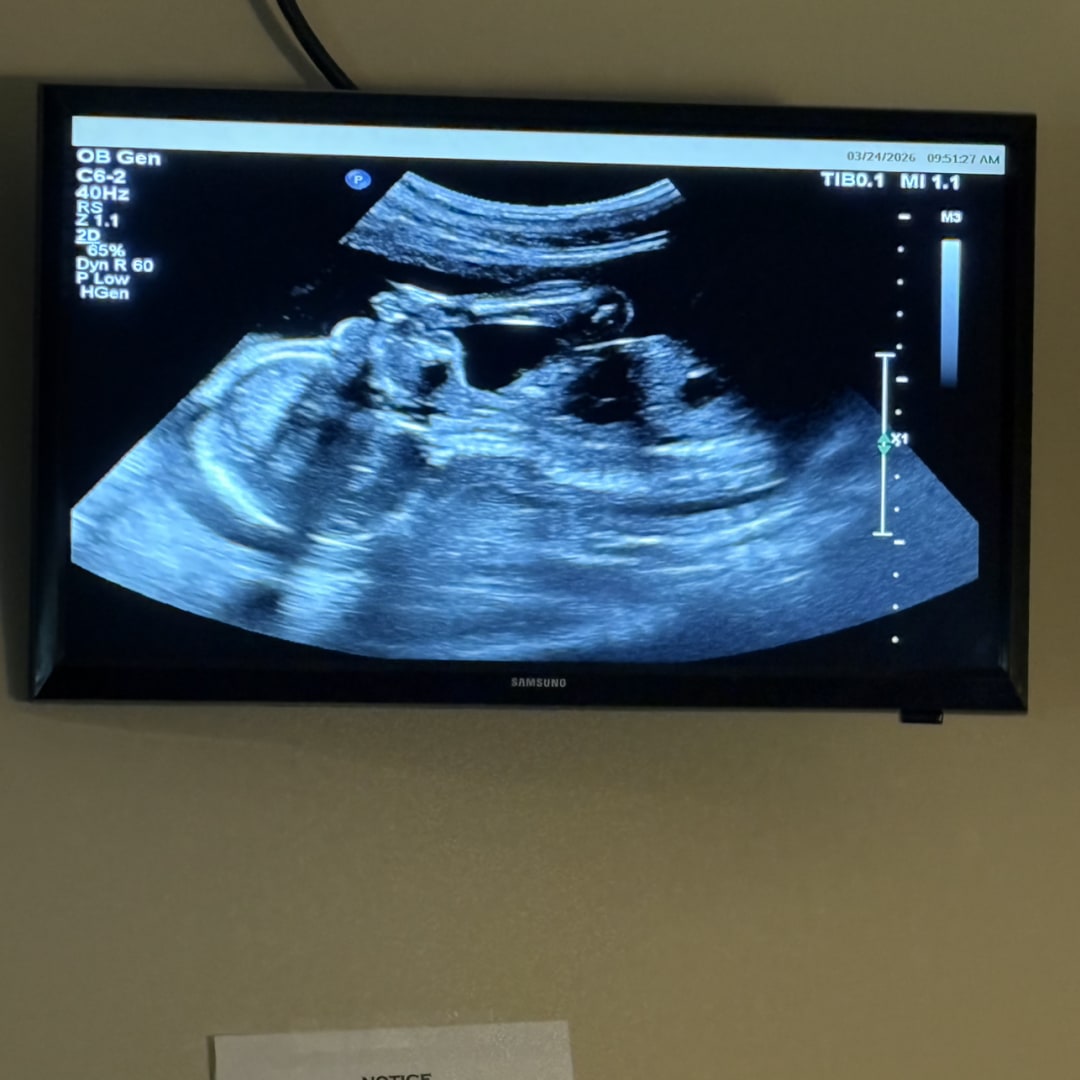 Photo shared by S’coria for their Babylist baby registry.