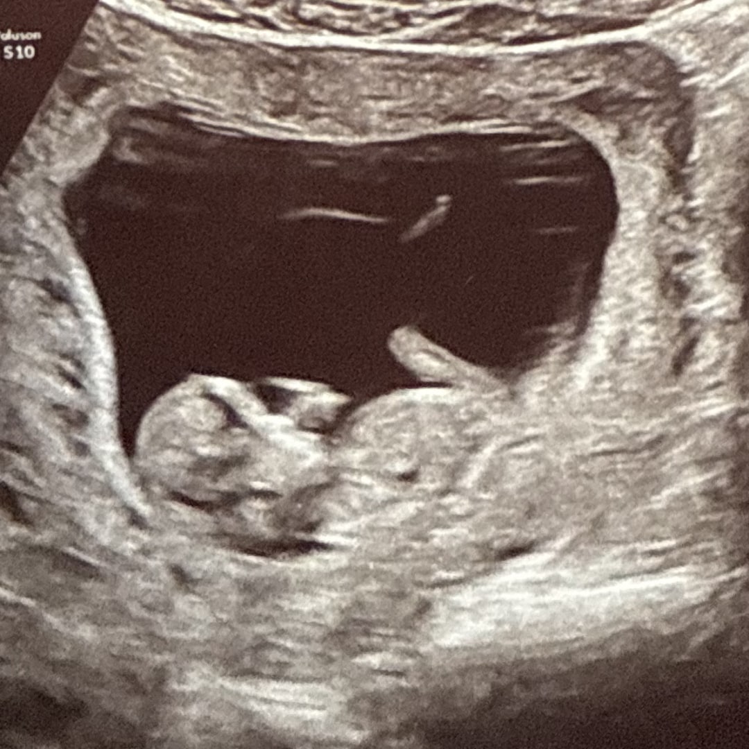 Photo shared by Tailor for their Babylist baby registry.