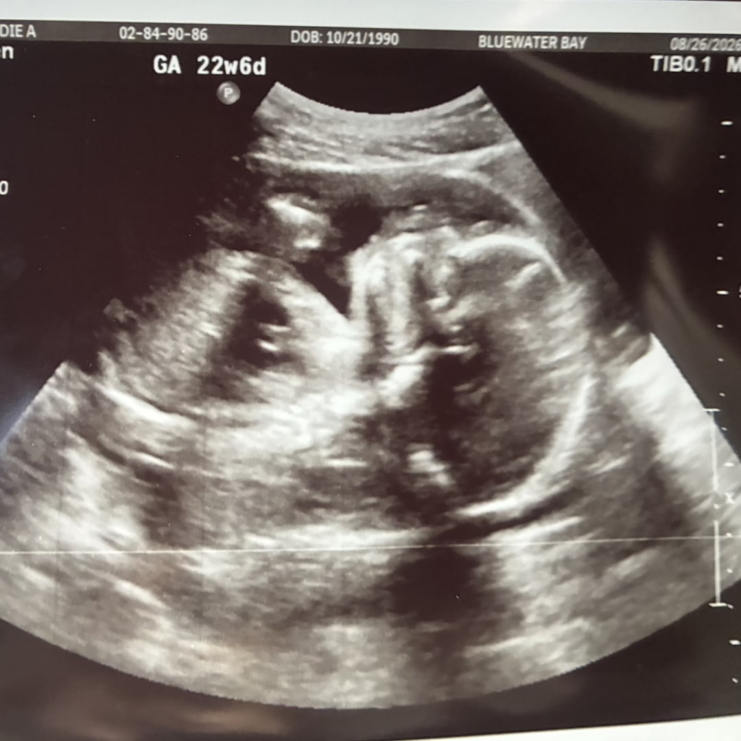 Photo shared by Jodie for their Babylist baby registry.