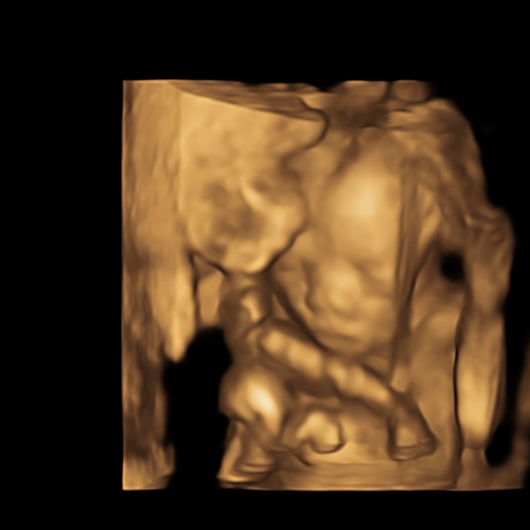 Photo shared by Malinda for their Babylist baby registry.