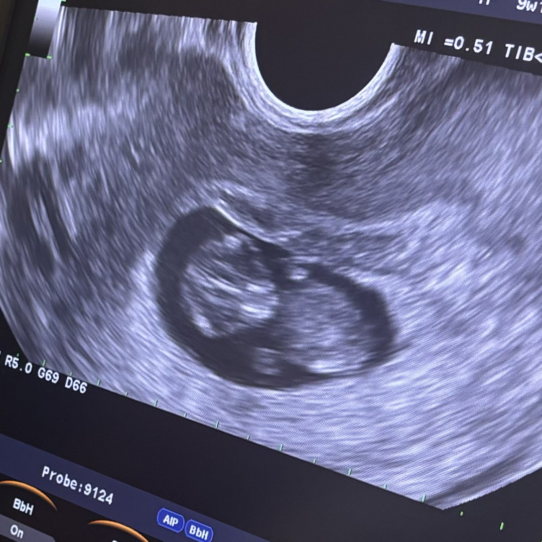 Photo shared by Tiare for their Babylist baby registry.