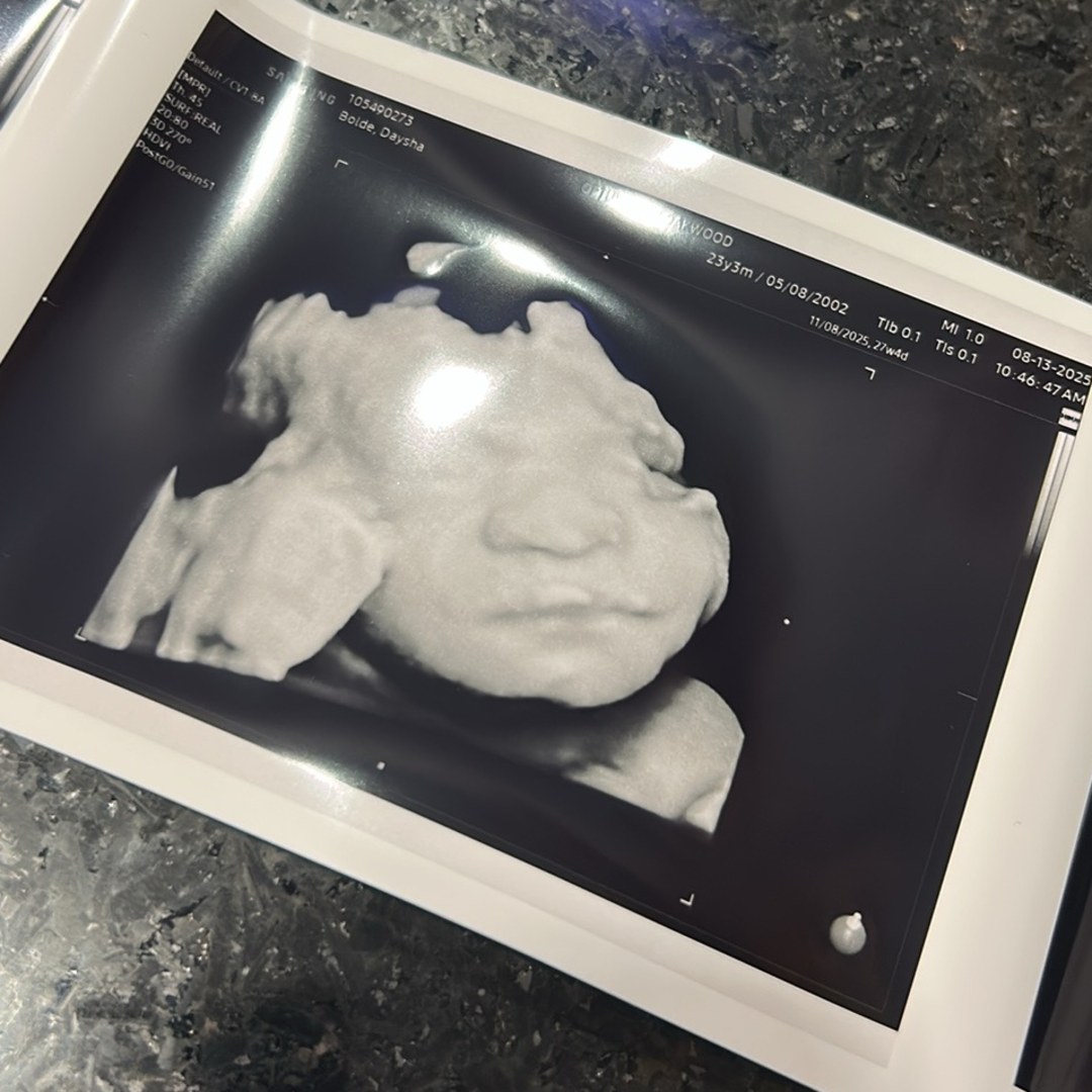 Photo shared by Daysha for their Babylist baby registry.