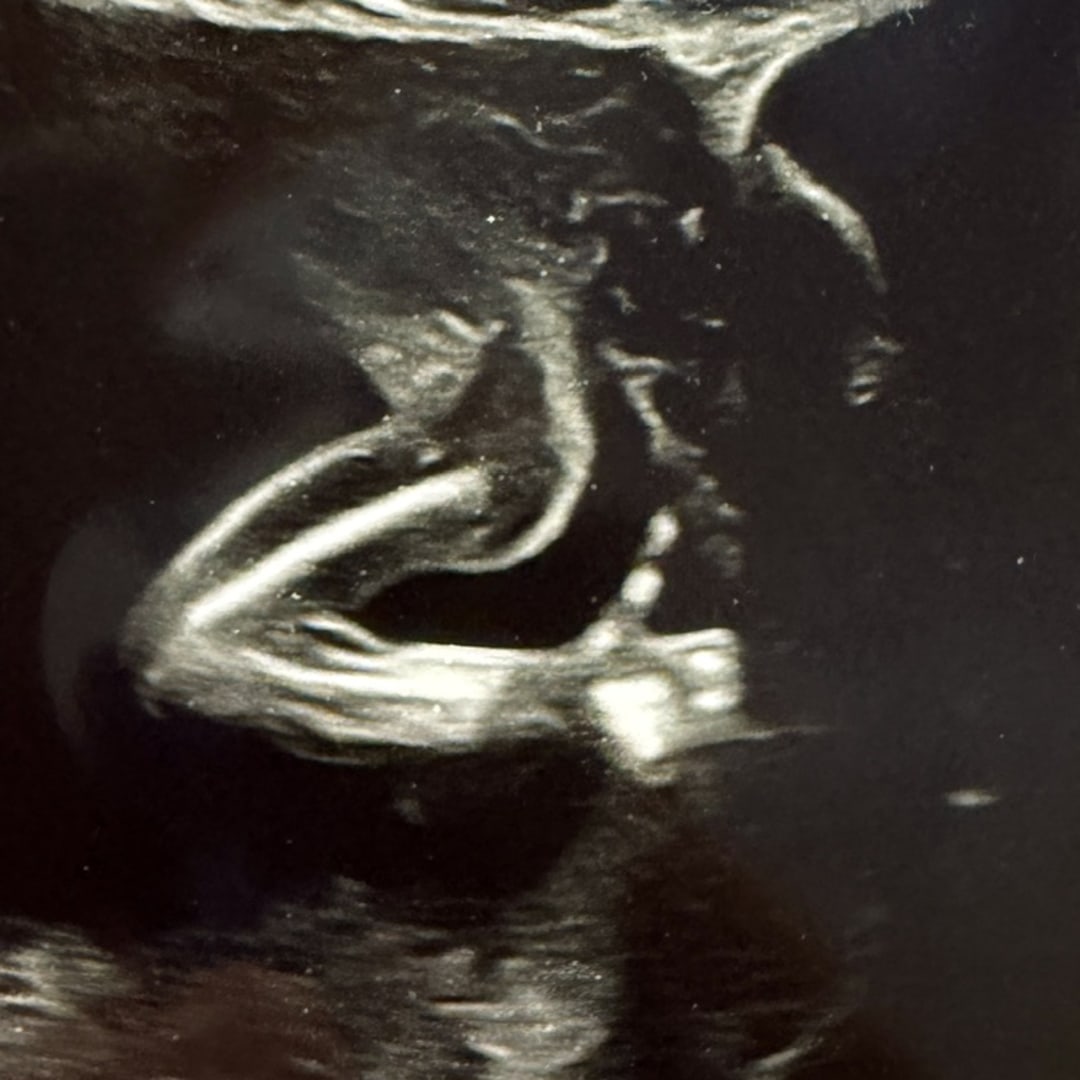 Photo shared by Ashley for their Babylist baby registry.