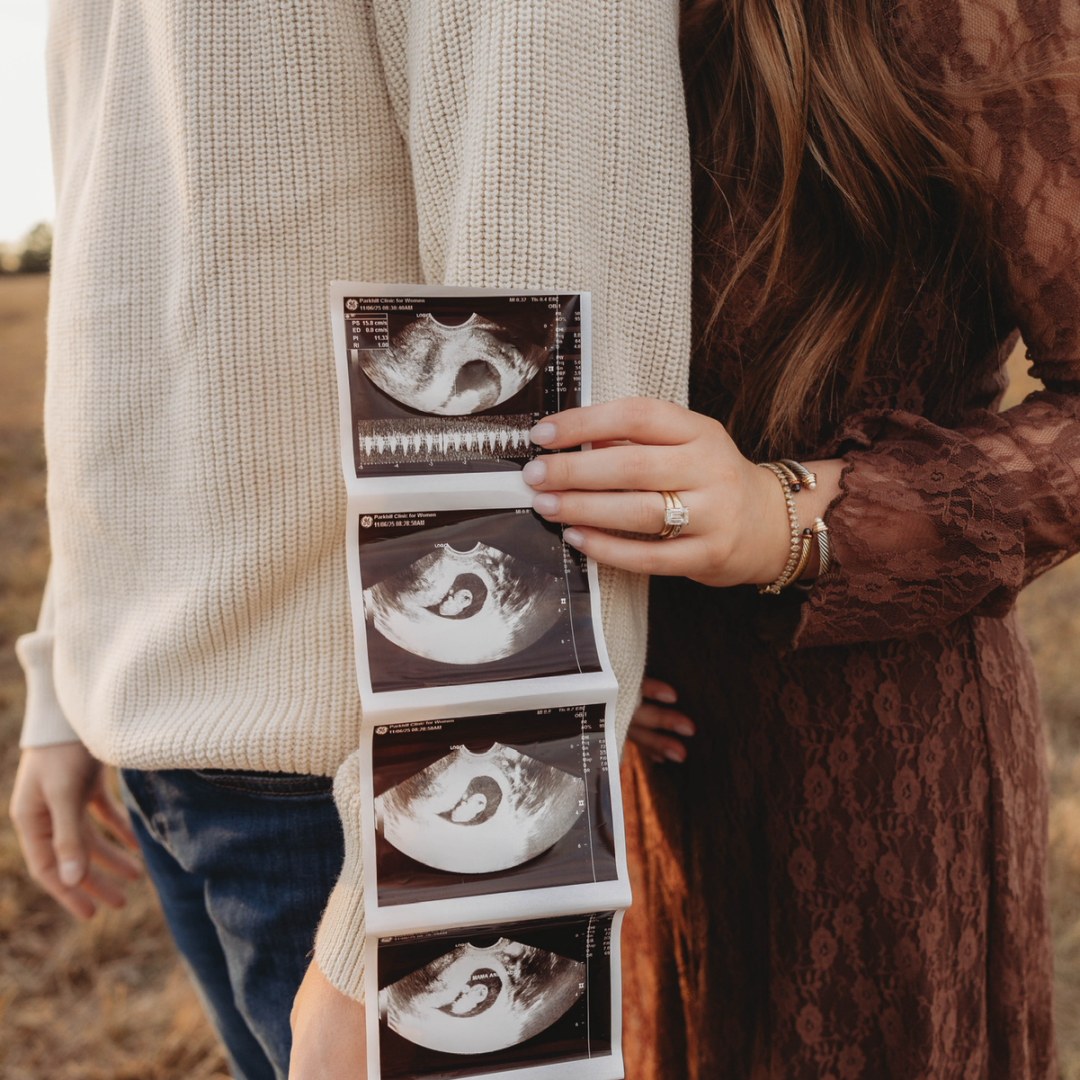 Photo shared by Makayla for their Babylist baby registry.