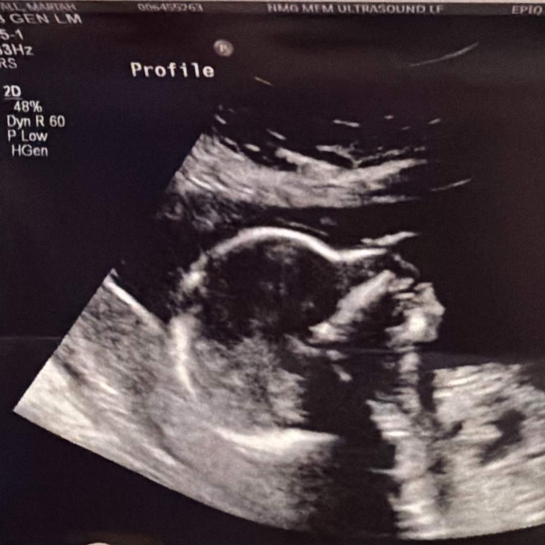 Photo shared by Mariah for their Babylist baby registry.