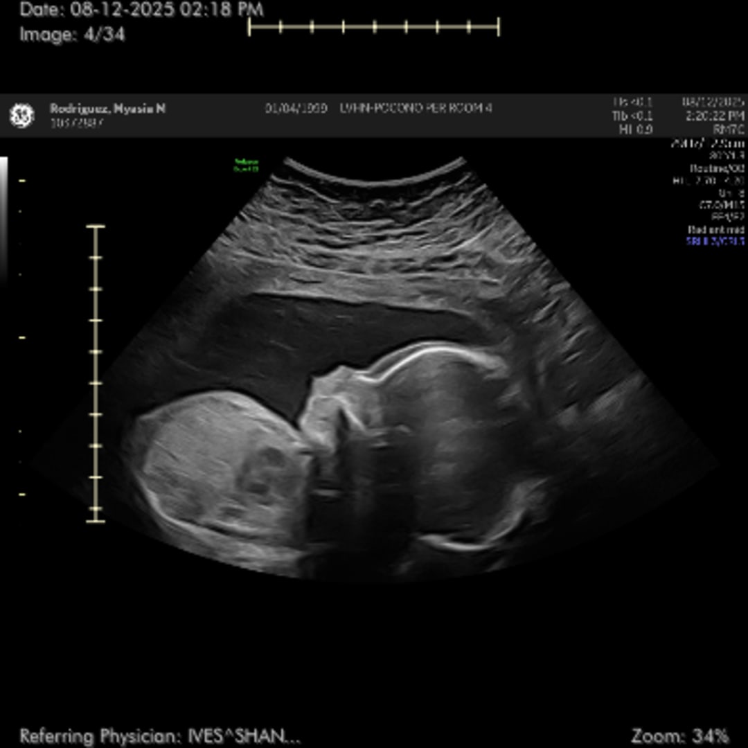 Photo shared by Myasia for their Babylist baby registry.