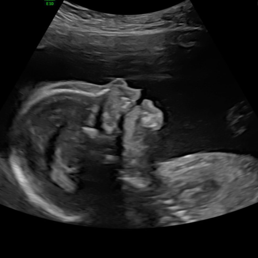 Photo shared by Caroline for their Babylist baby registry.