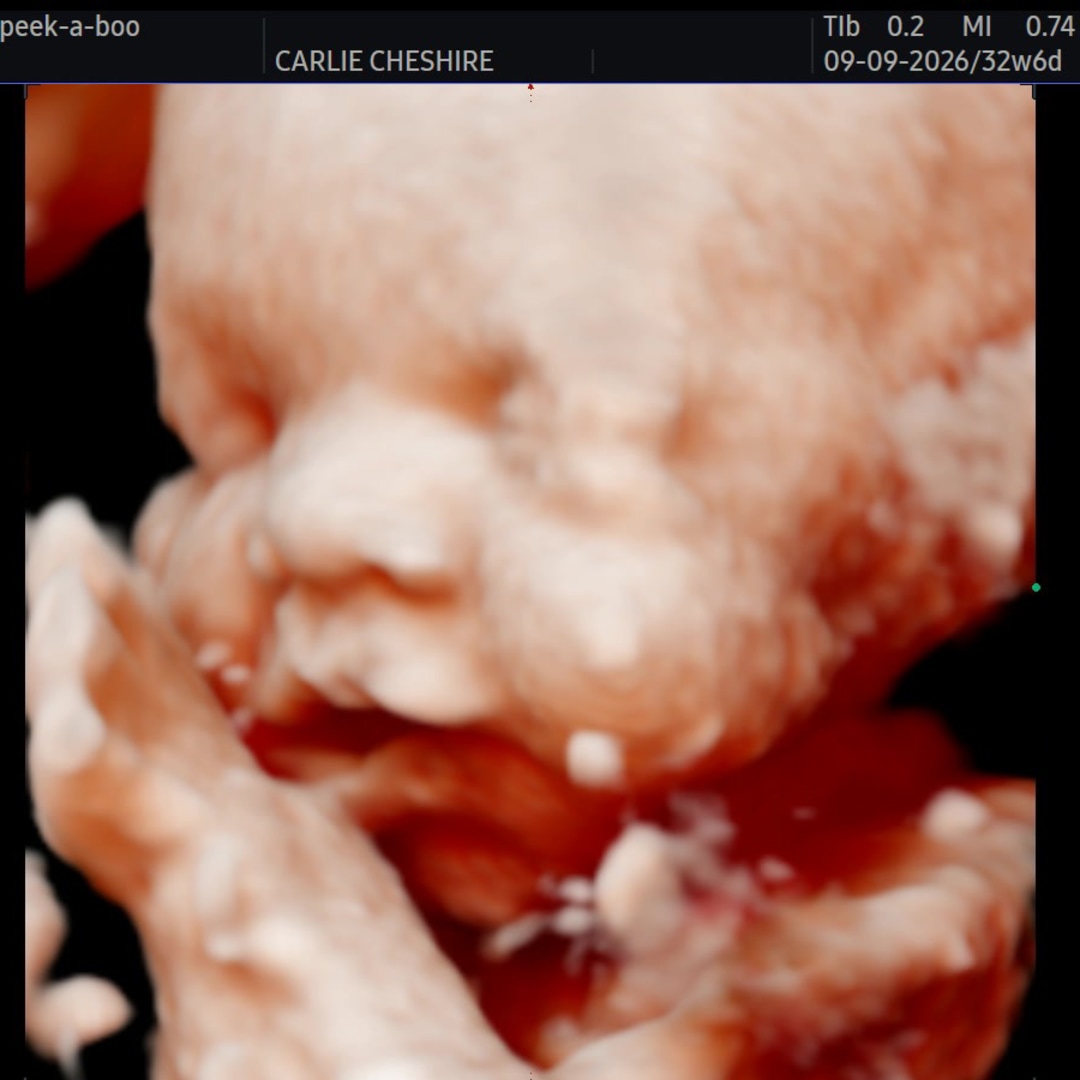 Photo shared by Carlie for their Babylist baby registry.