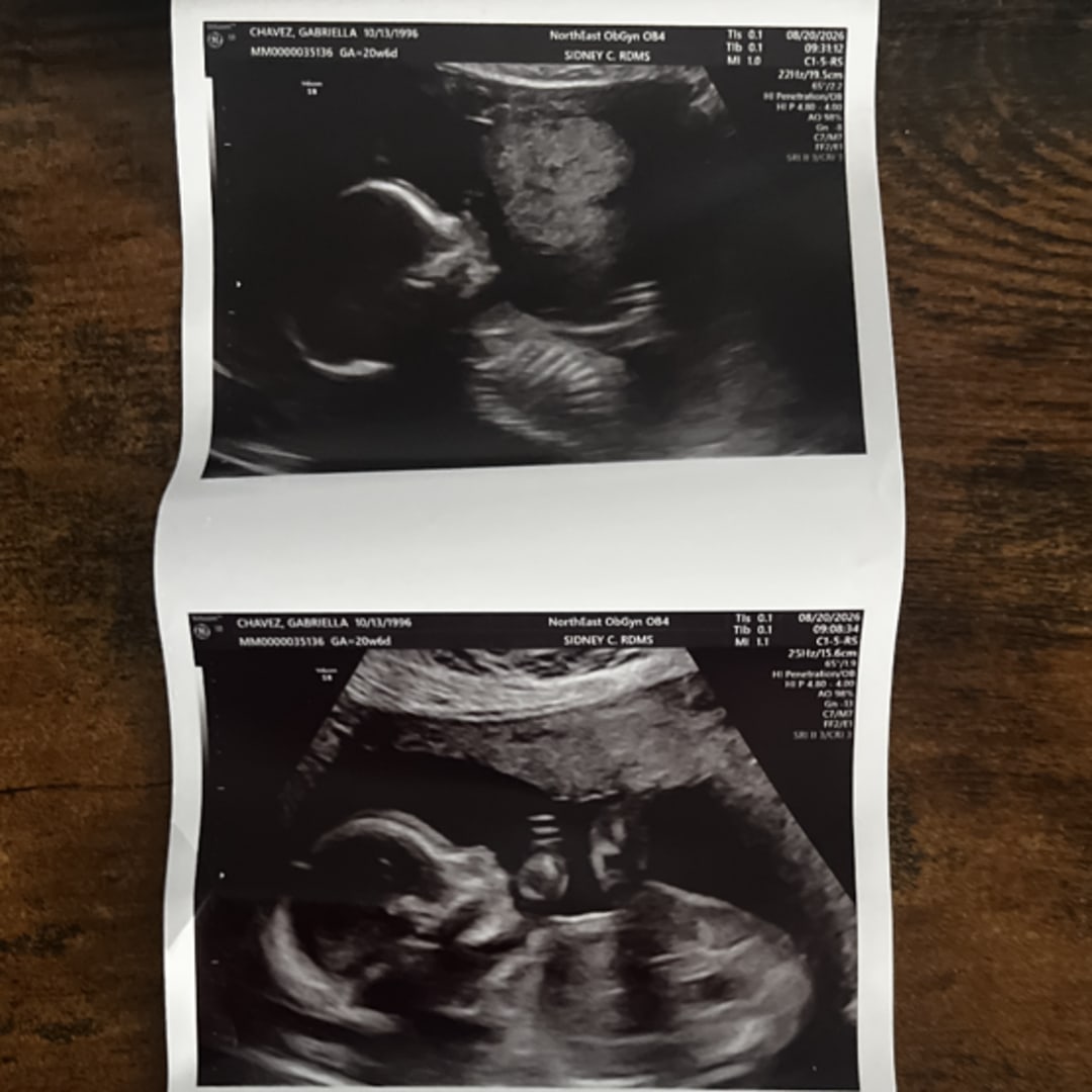 Photo shared by Gabriella for their Babylist baby registry.