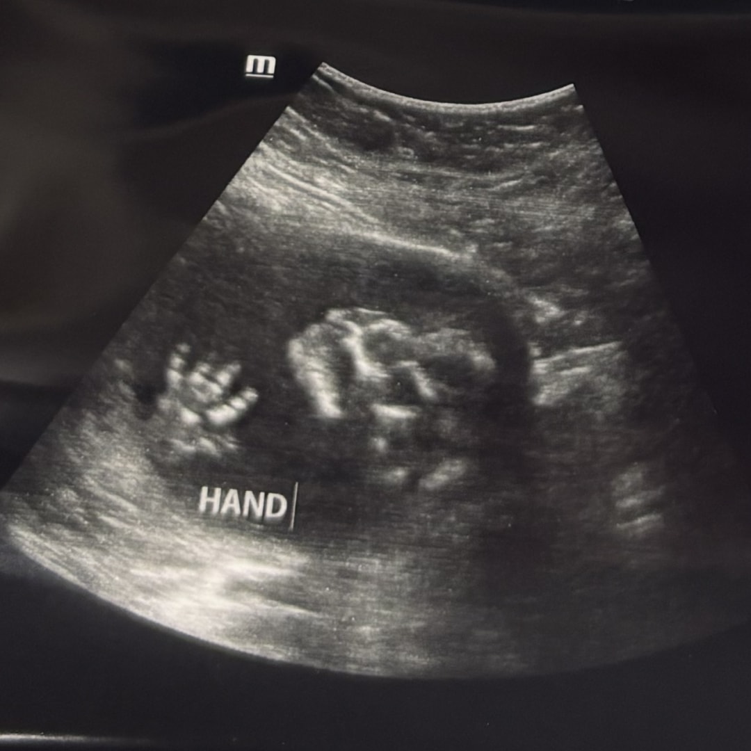 Photo shared by Ann Marie for their Babylist baby registry.