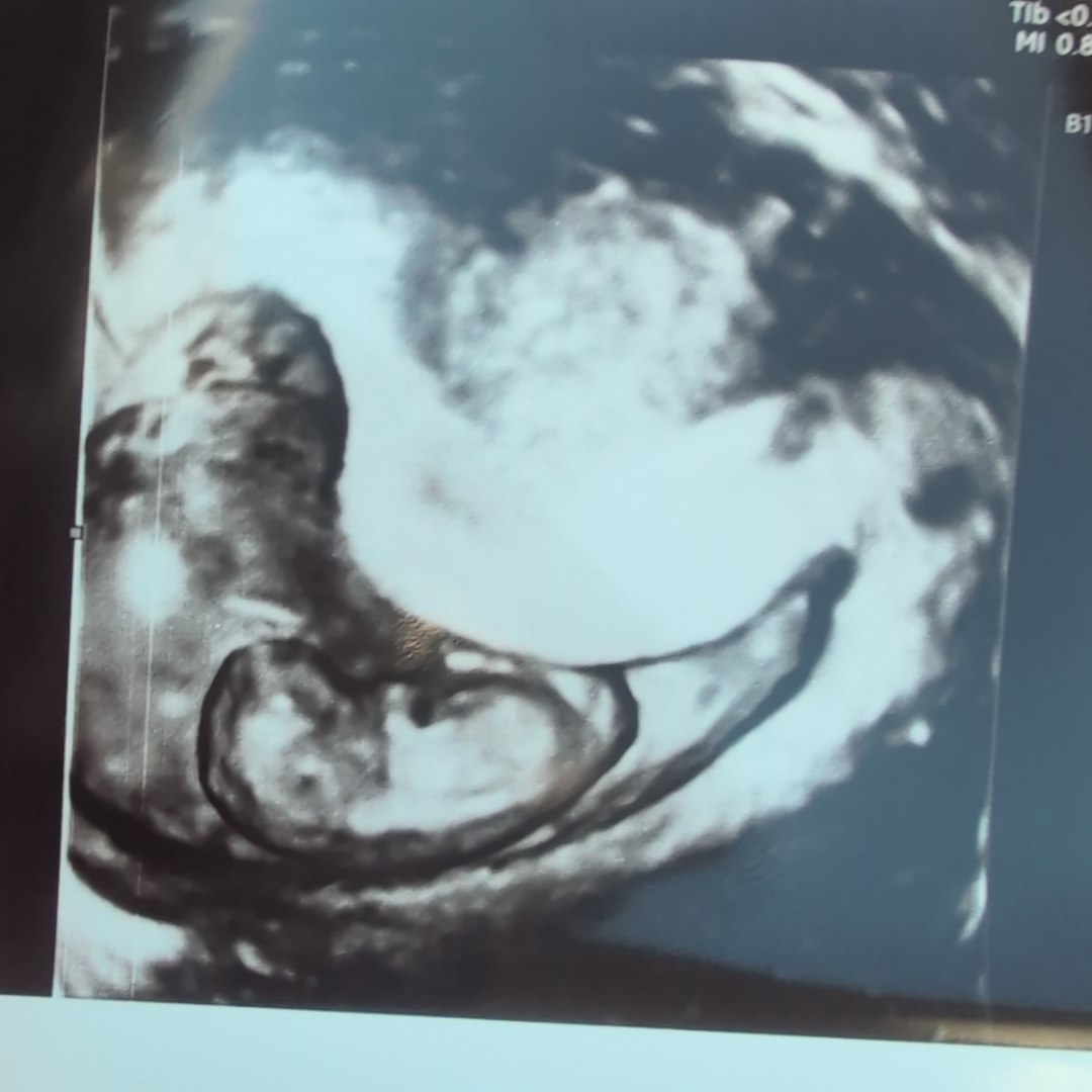 Photo shared by Amber for their Babylist baby registry.