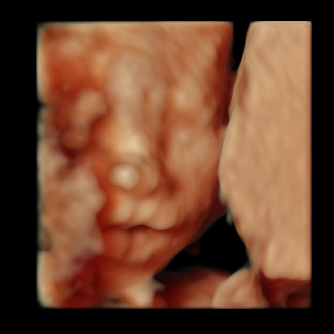 Photo shared by Kelsey for their Babylist baby registry.