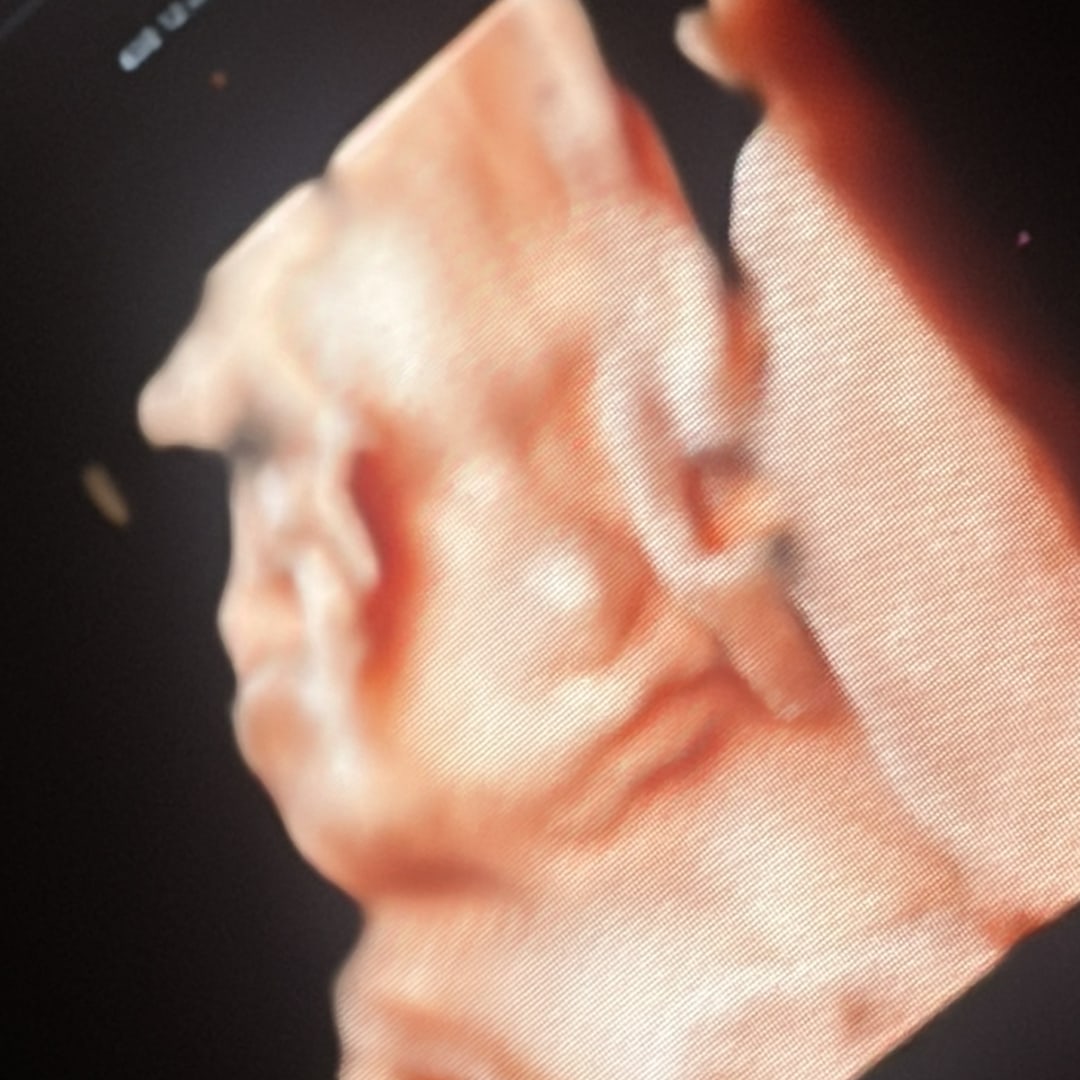 Photo shared by Juliet for their Babylist baby registry.