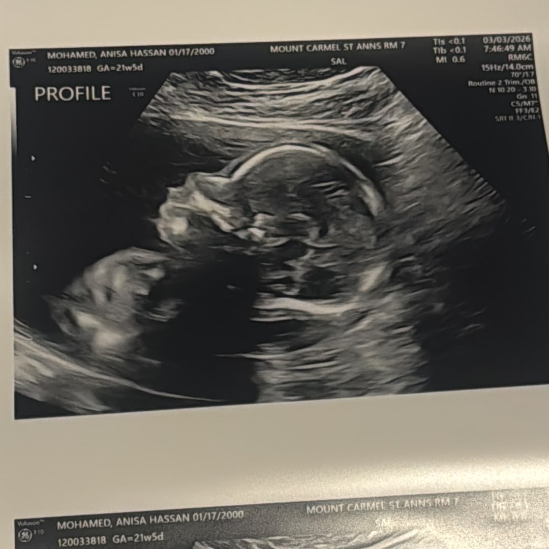 Photo shared by Anisa for their Babylist baby registry.