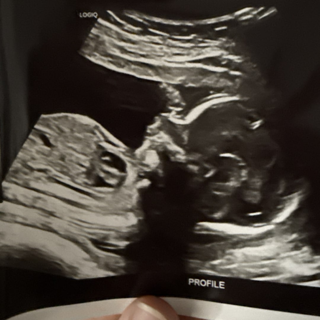 Photo shared by Marissa for their Babylist baby registry.