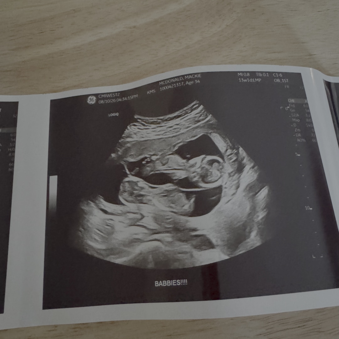 Photo shared by Mackie for their Babylist baby registry.