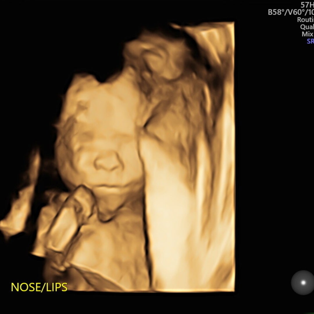Photo shared by Kristy for their Babylist baby registry.