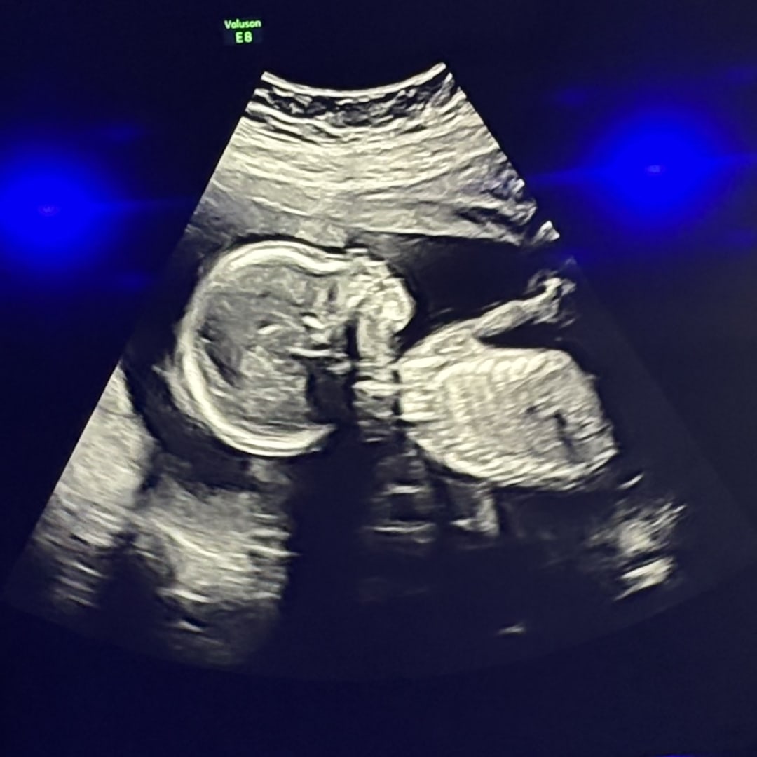 Photo shared by Elijah for their Babylist baby registry.