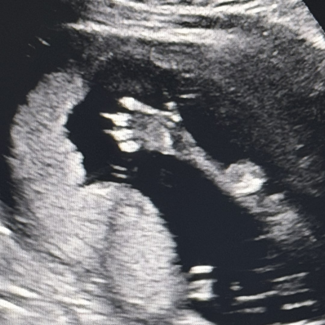 Photo shared by Lexi for their Babylist baby registry.