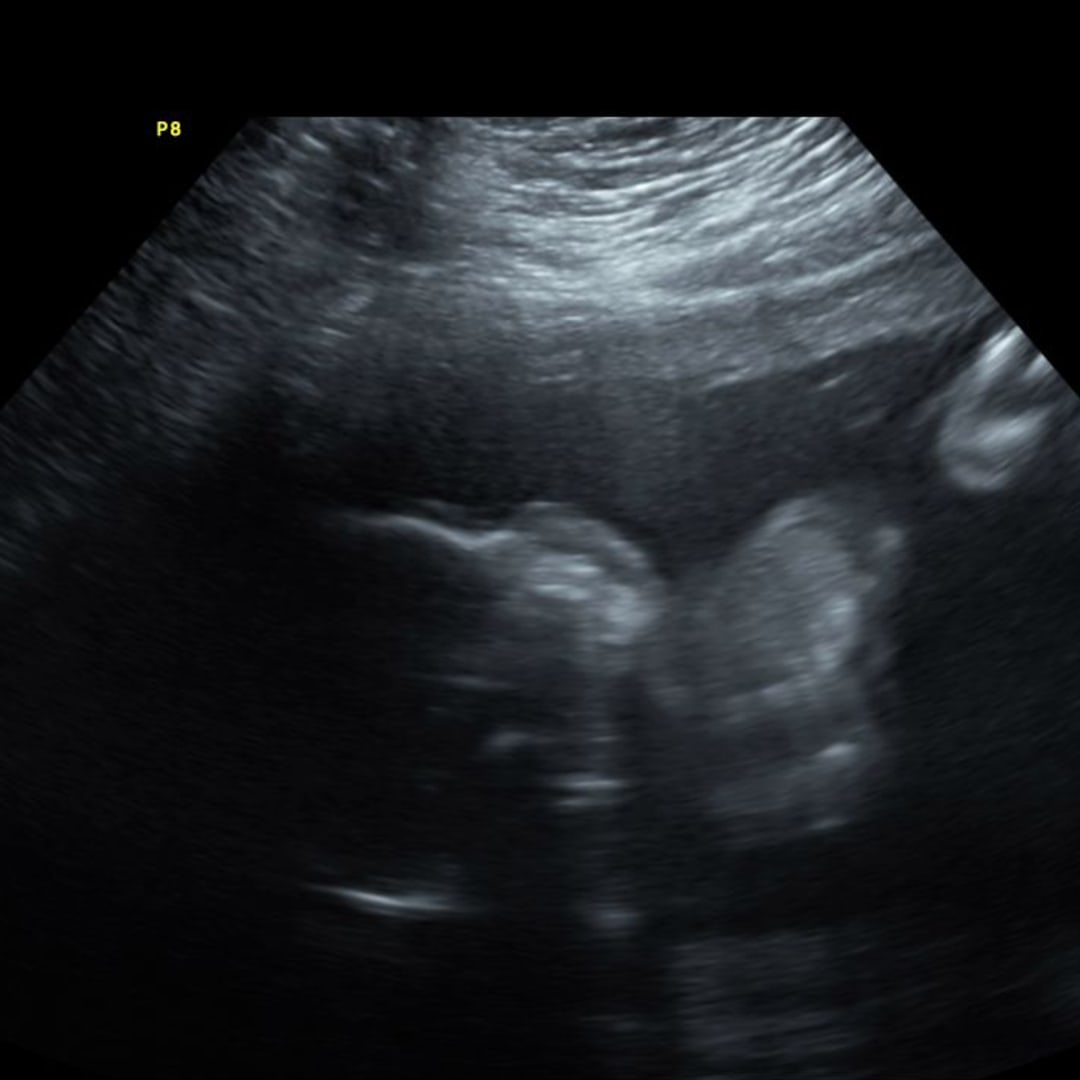 Photo shared by Alayna for their Babylist baby registry.