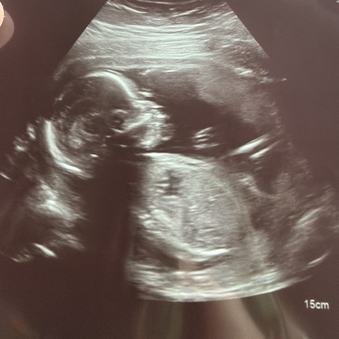 Photo shared by AunJelle for their Babylist baby registry.