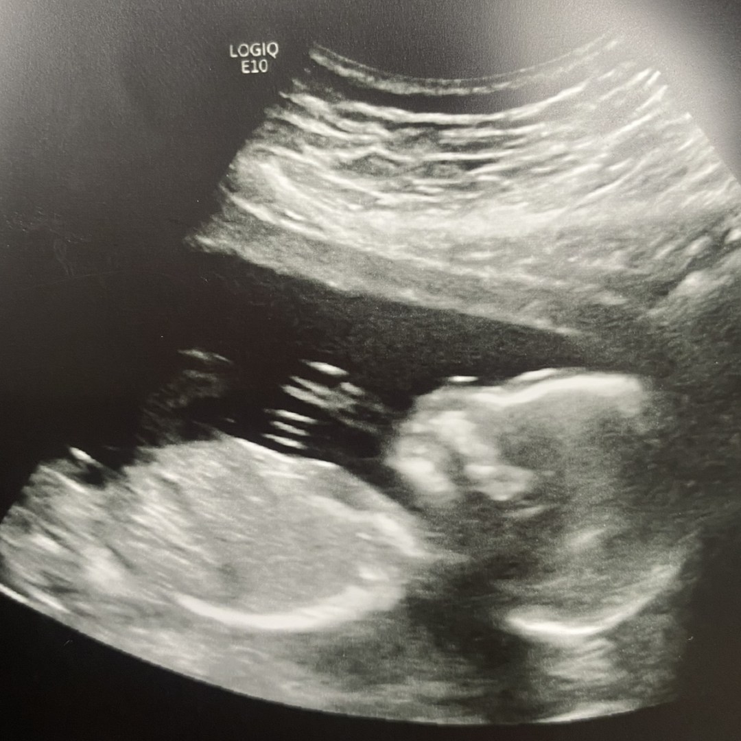 Photo shared by Corinna for their Babylist baby registry.